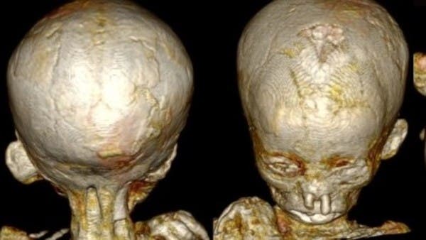 مرض شاع في مصر القديمة.. مومياوات الأطفال تكشف