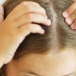 أسباب تساقط الشعر عند الأطفال وطرق علاجه