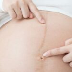 كيف أعرف جنس الجنين من شكل البطن