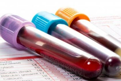 هل تحليل الدم العادي للحمل يخطئ